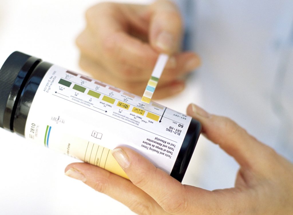 Pomiar ketonów: jak zmierzyć poziom ciał ketonowych? - Ketowariatka.pl